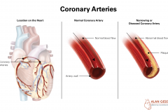 Coronary Arteries